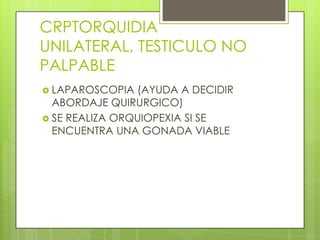 CRPTORQUIDIA
UNILATERAL, TESTICULO NO
PALPABLE
 LAPAROSCOPIA  (AYUDA A DECIDIR
  ABORDAJE QUIRURGICO)
 SE REALIZA ORQUIOPEXIA SI SE
  ENCUENTRA UNA GONADA VIABLE
 