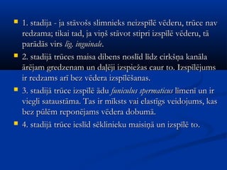    1. stadija - ja stāvošs slimnieks neizspīlē vēderu, trūce nav
    redzama; tikai tad, ja viņš stāvot stipri izspīlē vēderu, tā
    parādās virs lig. inguinale.
   2. stadijā trūces maisa dibens noslīd līdz cirkšņa kanāla
    ārējam gredzenam un daļēji izspiežas caur to. Izspīlējums
    ir redzams arī bez vēdera izspīlēšanas.
   3. stadijā trūce izspīlē ādu funiculus spermaticus līmenī un ir
    viegli sataustāma. Tas ir mīksts vai elastīgs veidojums, kas
    bez pūlēm reponējams vēdera dobumā.
   4. stadijā trūce ieslīd sēklinieku maisiņā un izspīlē to.
 