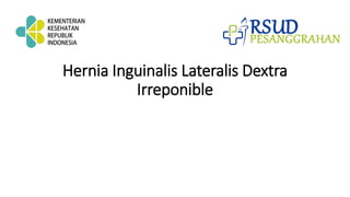 Hernia Inguinalis Lateralis Dextra
Irreponible
 