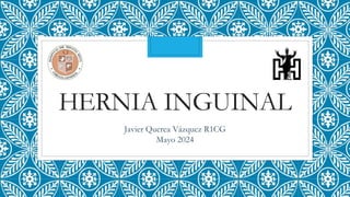 HERNIA INGUINAL
Javier Querea Vázquez R1CG
Mayo 2024
 