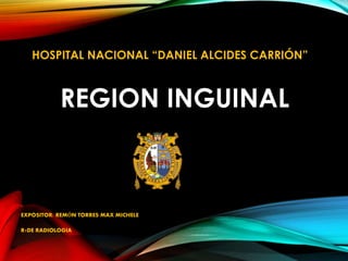 REGION INGUINAL
EXPOSITOR: REMÓN TORRES MAX MICHELE
R1DE RADIOLOGIA
HOSPITAL NACIONAL “DANIEL ALCIDES CARRIÓN”
 