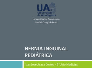 HERNIA INGUINAL
PEDIÁTRICA
Juan José Araya Cortés – 5° Año Medicina
Universidad de Antofagasta
Unidad Cirugía Infantil
 