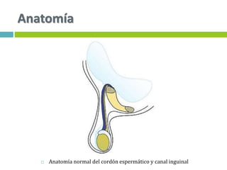 Anatomía
 Anatomía normal del cordón espermático y canal inguinal
 