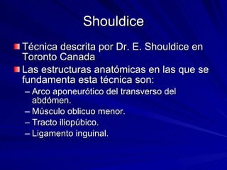 Shouldice Técnica descrita por Dr. E. Shouldice en Toronto Canada Las estructuras anatómicas en las que se fundamenta esta técnica son: Arco aponeurótico del transverso del abdómen. Músculo oblicuo menor. Tracto iliopúbico. Ligamento inguinal. 