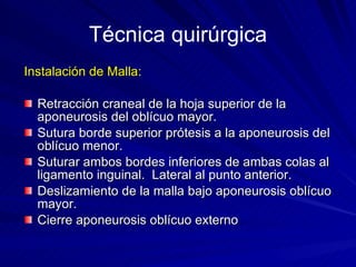 Instalación de Malla: Retracción craneal de la hoja superior de la aponeurosis del oblícuo mayor. Sutura borde superior prótesis a la aponeurosis del oblícuo menor. Suturar ambos bordes inferiores de ambas colas al ligamento inguinal.  Lateral al punto anterior. Deslizamiento de la malla bajo aponeurosis oblícuo mayor. Cierre aponeurosis oblícuo externo . Técnica quirúrgica 