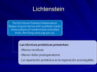 Lichtenstein 