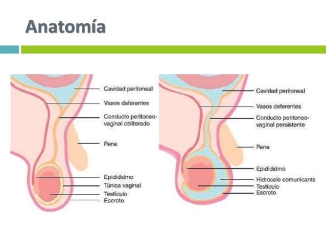 Hernias inguinales pediatria pdf