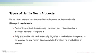 Hernia Mesh Lawsuit in Canada: Presentation | PDF