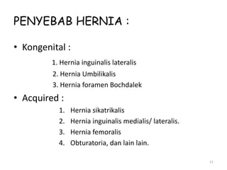 PENYEBAB HERNIA :
• Kongenital :
1. Hernia inguinalis lateralis
2. Hernia Umbilikalis
3. Hernia foramen Bochdalek
• Acquired :
1. Hernia sikatrikalis
2. Hernia inguinalis medialis/ lateralis.
3. Hernia femoralis
4. Obturatoria, dan lain lain.
11
 