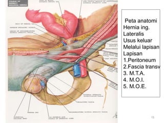 15
Peta anatomi
Hernia ing.
Lateralis
Usus keluar
Melalui lapisan
Lapisan
1.Peritoneum
2.Fascia transv
3. M.T.A.
4. M.O.I.
5. M.O.E.
 