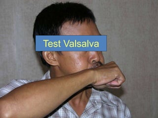 18
Test Valsalva
 