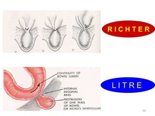 65
L I T R E
R I C H T E R
 