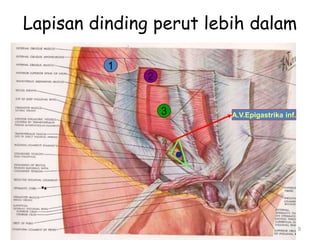 Lapisan dinding perut lebih dalam
9
1
2
3 A.V.Epigastrika inf.
 