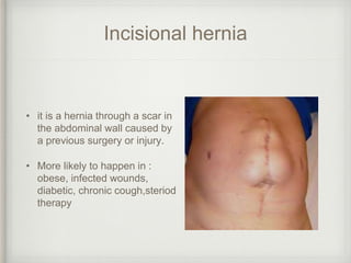 Incisional hernia
• it is a hernia through a scar in
the abdominal wall caused by
a previous surgery or injury.
• More likely to happen in :
obese, infected wounds,
diabetic, chronic cough,steriod
therapy
 