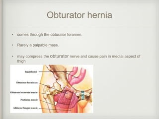 Obturator hernia
• comes through the obturator foramen.
• Rarely a palpable mass.
• may compress the obturator nerve and cause pain in medial aspect of
thigh
 