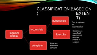 CLASSIFICATION
(
BASED ON
EXTEN
T)
Sac is confined
to
inguinalcanal
bubonocele
incomplete Sac crosses
superficial
ring but not
reaches
bottom of
scrotum
Inguinal
hernia
funicular
Reaches
bottom of
scrotum
complete
 