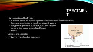 TREATMEN
T
• High operation of McEvedy
• A incision above the inguinal ligament. Sac is dissected from below, neck
• from above and repair is done from above. It gives a
• very good exposure of both neck, fundus of sac and
• repair is also easier. strangulated femoral
• hernia
• Lotheissens operation
• Lockwood operation low approach
 