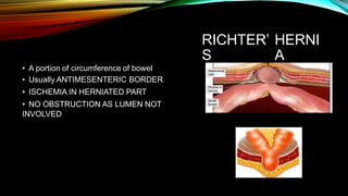 RICHTER’
S
HERNI
A
• A portion of circumference of bowel
• Usually ANTIMESENTERIC BORDER
• ISCHEMIA IN HERNIATED PART
• NO OBSTRUCTION AS LUMEN NOT
INVOLVED
 