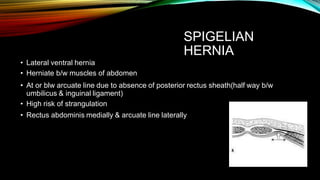 SPIGELIAN
HERNIA
• Lateral ventral hernia
• Herniate b/w muscles of abdomen
• At or blw arcuate line due to absence of posterior rectus sheath(half way b/w
umbilicus & inguinal ligament)
• High risk of strangulation
• Rectus abdominis medially & arcuate line laterally
 