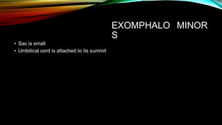 EXOMPHALO
S
MINOR
• Sac is small
• Umbilical cord is attached to its summit
 