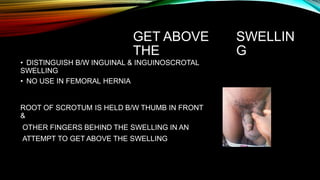 GET ABOVE
THE
SWELLIN
G
• DISTINGUISH B/W INGUINAL & INGUINOSCROTAL
SWELLING
• NO USE IN FEMORAL HERNIA
ROOT OF SCROTUM IS HELD B/W THUMB IN FRONT
&
OTHER FINGERS BEHIND THE SWELLING IN AN
ATTEMPT TO GET ABOVE THE SWELLING
 