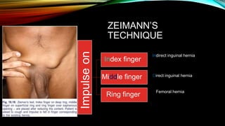 ZEIMANN’S
TECHNIQUE
Indirect inguinal hernia
Direct inguinal hernia
Femoral hernia
Impulse
on
Index finger
Middle finger
Ring finger
 