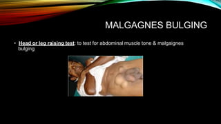 MALGAGNES BULGING
• Head or leg raising test: to test for abdominal muscle tone & malgaignes
bulging
 
