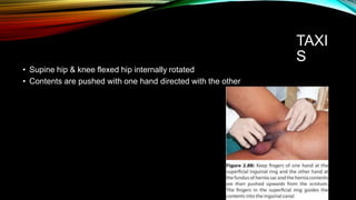 TAXI
S
• Supine hip & knee flexed hip internally rotated
• Contents are pushed with one hand directed with the other
 