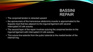 BASSINI
REPAIR
• The conjoined tendon is retracted upward
• the aponeurosis of the transversus abdominis muscle is approximated to the
iliopubic tract that lies adjacent to the inguinal ligament with several
interrupted 3-0 silk sutures.
• The second layer of the repair involves suturing the conjoined tendon to the
inguinal ligament with interrupted 2-0 silk sutures.
• This suture line extends from the pubic tubercle to the medial border of the
internal ring.
 