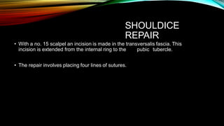 SHOULDICE
REPAIR
• With a no. 15 scalpel an incision is made in the transversalis fascia. This
incision is extended from the internal ring to the pubic tubercle.
• The repair involves placing four lines of sutures.
 
