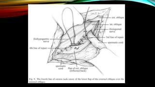 Tanner's muscle slide
 