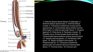 1, External oblique fascia (fascia of Gallaudet); 2,
External oblique aponeurosis; 3, Internal oblique
muscle; 4, Transversus abdominis muscle and its
aponeurosis; 5, Transversalis fascia anterior lamina
(third layer); 6, External spermatic fascia; 7, Cooper's
ligament; 8, Pubic bone; 9, Pectineus muscle; 10,
Possible union of transversalis fascia laminae; 11,
Transversalis fascia posterior lamina (second layer);
12, Vessels (second space); 13, Peritoneum (first
layer); 14, Space of Bogros (first space); 15,
Preperitoneal fat; 16, Transversus abdominis
aponeurosis and anterior lamina of transversalis
fascia; 17, Femoral artery; 18, Femoral vein.
TONY 2010
MBBS
 