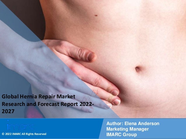 Copyright © IMARC Service Pvt Ltd. All Rights Reserved
Global Hernia Repair Market
Research and Forecast Report 2022-
2027
Author: Elena Anderson
Marketing Manager
IMARC Group
© 2022 IMARC All Rights Reserved
 