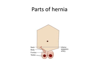 Parts of hernia
 