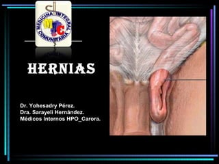 HERNIAS

Dr. Yohesadry Pérez.
Dra. Sarayeli Hernández.
Médicos Internos HPO_Carora.
 