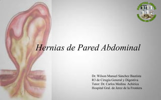 Hernias de Pared Abdominal
Dr. Wilson Manuel Sánchez Bautista
R3 de Cirugía General y Digestiva
Tutor: Dr. Carlos Medina Achirica
Hospital Gral. de Jerez de la Frontera
1
 