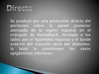 Se produce por una protrusión directa del 
peritoneo sobre la pared posterior 
atenuada de la región inguinal en el 
triángulo de Hesselbach, formado a los 
lados por el ligamento inguinal y el borde 
externo del músculo recto del abdomen; 
la base la constituyen los vasos 
epigástricos inferiores. 
 