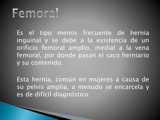 Es el tipo menos frecuente de hernia 
inguinal y se debe a la existencia de un 
orificio femoral amplio, medial a la vena 
femoral, por donde pasan el saco herniario 
y su contenido. 
Esta hernia, común en mujeres a causa de 
su pelvis amplia, a menudo se encarcela y 
es de difícil diagnóstico 
 