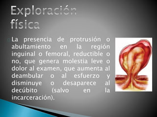 La presencia de protrusión o 
abultamiento en la región 
inguinal o femoral, reductible o 
no, que genera molestia leve o 
dolor al examen, que aumenta al 
deambular o al esfuerzo y 
disminuye o desaparece al 
decúbito (salvo en la 
incarceración). 
 