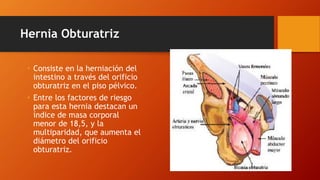 hernias-pptx