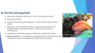  Mayoría son inguinales indirectas (1-3% y en extremos de la vida)
 Femorales (15-20%)
 Grandes hernias con cuellos pequeños  obstrucción de flujo arterial y
venoso
 Adherencia entre contenido herniario y túnica peritoneal del saco 
atrapamiento de contenido herniario  obstrucción intestinal y
estrangulación
 Contenido con perfusión sanguínea insuficiente (complicación grave)
 Hernia de Ritcher  atrapamiento de pequeña porción antimesentérica de
intestino que produce estrangulación sin obstrucción intestinal
 