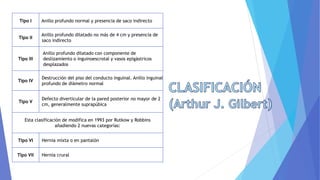 Tipo I Anillo profundo normal y presencia de saco indirecto
Tipo II
Anillo profundo dilatado no más de 4 cm y presencia de
saco indirecto
Tipo III
Anillo profundo dilatado con componente de
deslizamiento o inguinoescrotal y vasos epigástricos
desplazados
Tipo IV
Destrucción del piso del conducto inguinal. Anillo inguinal
profundo de diámetro normal
Tipo V
Defecto diverticular de la pared posterior no mayor de 2
cm, generalmente suprapúbica
Esta clasificación de modifica en 1993 por Rutkow y Robbins
añadiendo 2 nuevas categorías:
Tipo VI Hernia mixta o en pantalón
Tipo VII Hernia crural
 