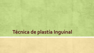 Técnica de plastía Inguinal
 