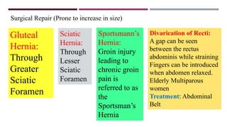 Hernias | PPTX