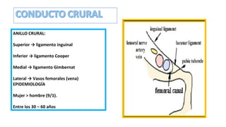 ANILLO CRURAL:
Superior → ligamento inguinal
Inferior → ligamento Cooper
Medial → ligamento Gimbernat
Lateral → Vasos femorales (vena)
EPIDEMIOLOGÍA
Mujer > hombre (9/1).
Entre los 30 – 60 años
 