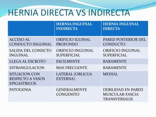 Hernia Inguinal Indirecta Vs Directa