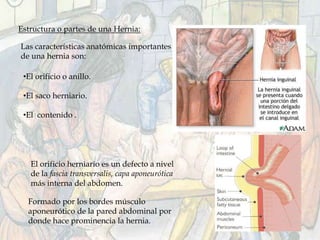 Estructura o partes de una Hernia:
Las características anatómicas importantes
de una hernia son:
•El orificio o anillo.
•El saco herniario.
•El contenido .
El orificio herniario es un defecto a nivel
de la fascia transversalis, capa aponeurótica
más interna del abdomen.
Formado por los bordes músculo
aponeurótico de la pared abdominal por
donde hace prominencia la hernia.
 