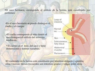 El saco herniario corresponde al orificio de la hernia, está constituido por
peritoneo.
•En el saco herniario se puede distinguir el
cuello y el cuerpo.
•El cuello corresponde al sitio donde el
saco franquea el orificio del músculo
tendinoso.
• El cuerpo es el resto del saco y tiene
dimensiones y formas variables.
•El contenido de la hernia está constituido por intestino delgado y epiplón;
otras vísceras, menos frecuentes son intestino grueso y vejiga, entre otros.
 