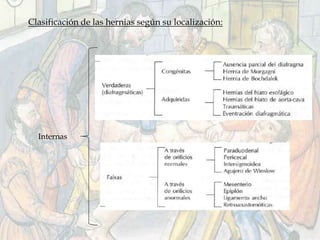 Clasificación de las hernias según su localización:
Internas
 