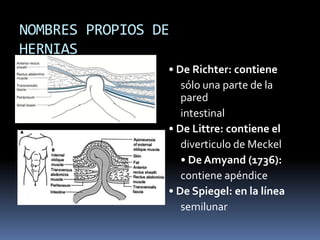 NOMBRES PROPIOS DE
HERNIAS
• De Richter: contiene
sólo una parte de la
pared
intestinal
• De Littre: contiene el
diverticulo de Meckel
• De Amyand (1736):
contiene apéndice
• De Spiegel: en la línea
semilunar
 
